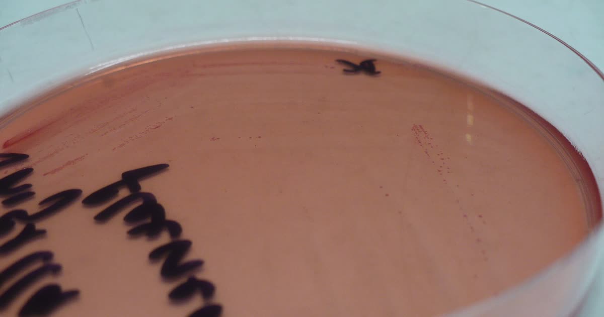 A laboratory culture plate with Shigella bacteria colonies
